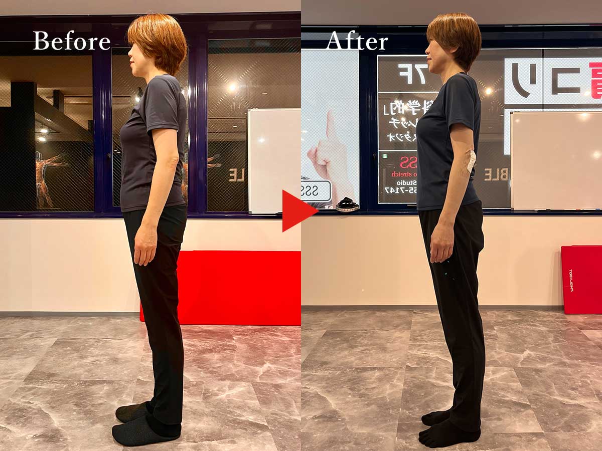 50代女性のビフォーとアフター比較写真1人目