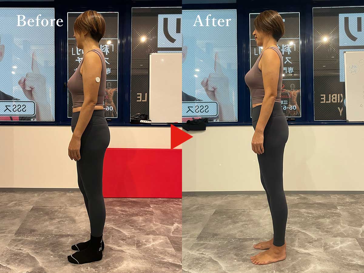 50代女性のビフォーとアフター比較写真1人目